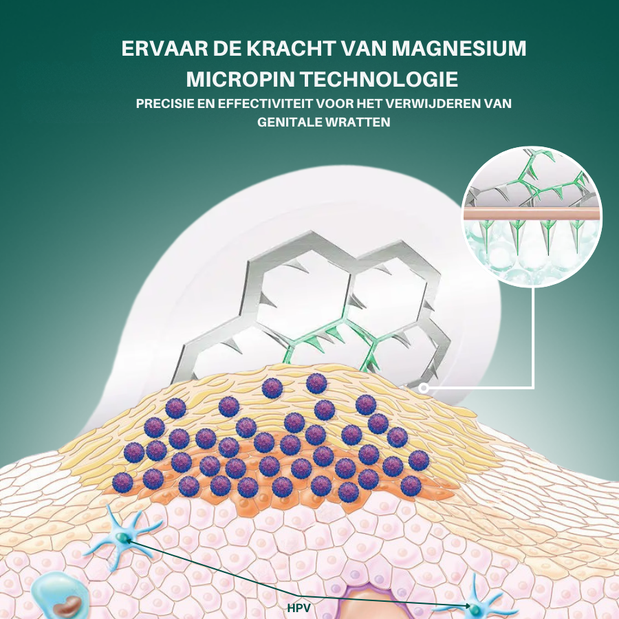 MicroPin HPV Magnesium Patch – Pijnloze Genitale Wratverwijdering in 14 Dagen