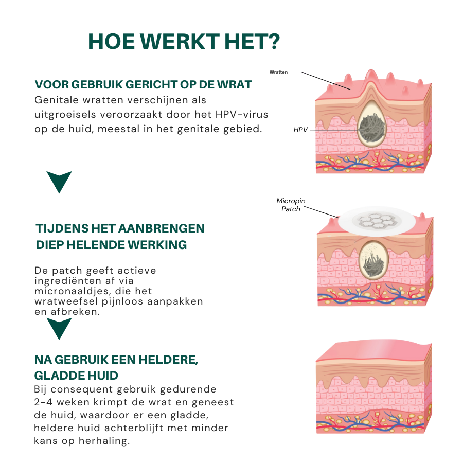 MicroPin HPV Magnesium Patch – Pijnloze Genitale Wratverwijdering in 14 Dagen