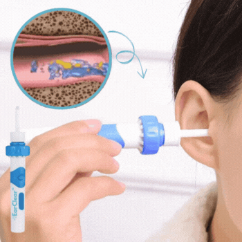 EarClear™ | Elektrische Oorsmeer Verwijderaar